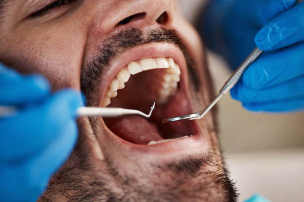 Best Emergency Gum Treatment in Garfield, NJ